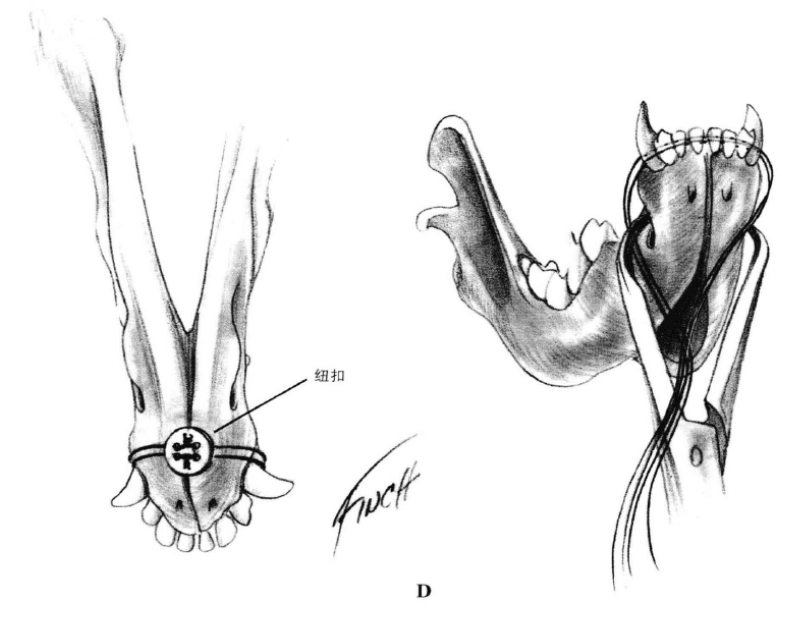 蜜桃成品人视频入口