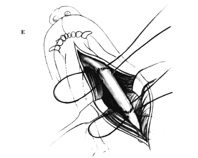 蜜桃成品人视频入口