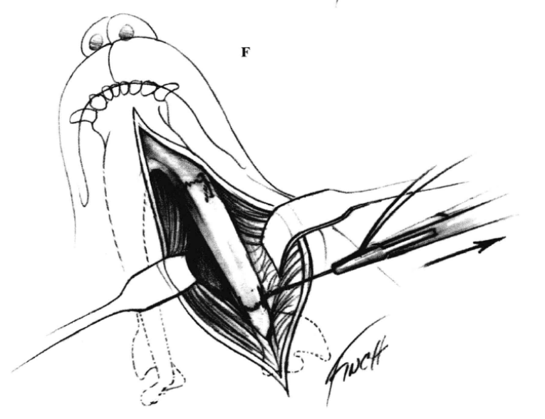 蜜桃成品人视频入口