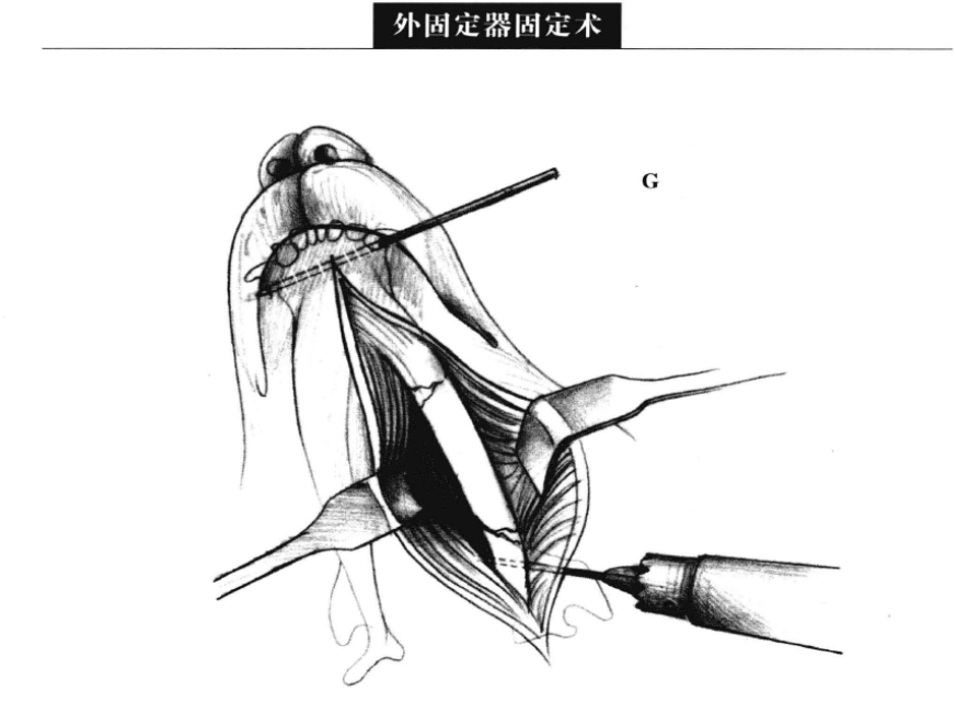 蜜桃成品人视频入口