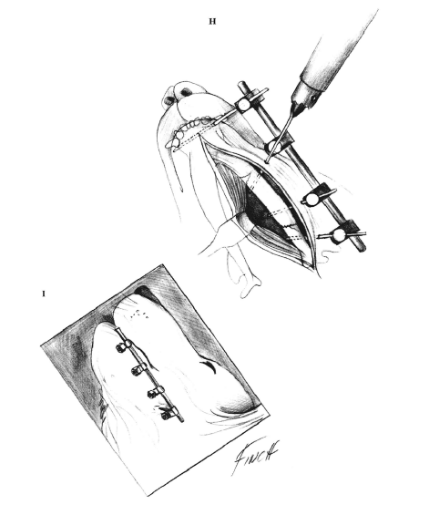 蜜桃成品人视频入口