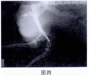 蜜桃成品人视频入口