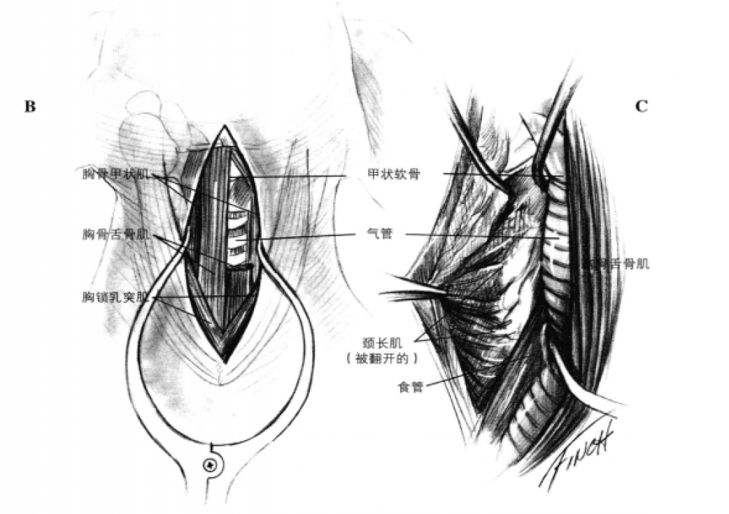 蜜桃成品人视频入口