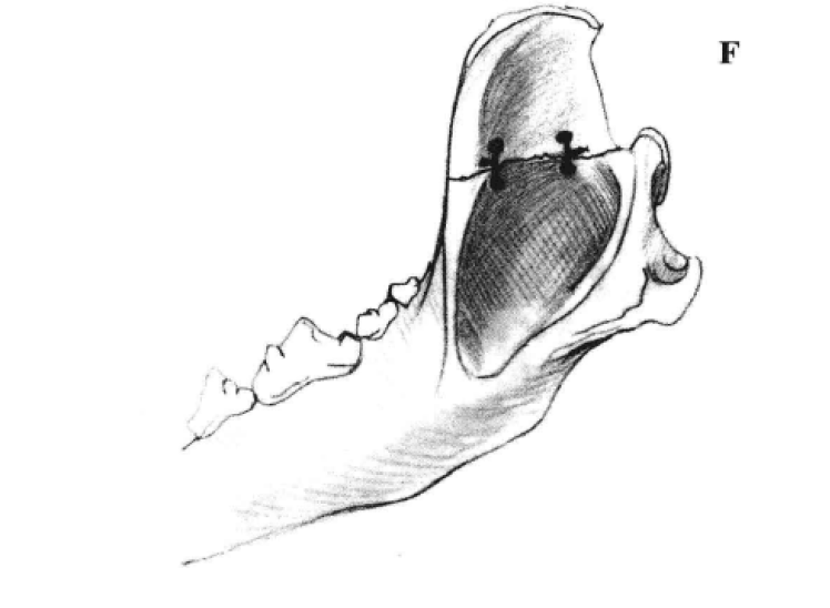矫形钢丝固定术 蜜桃成品人视频入口