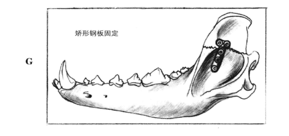 矫形钢丝固定术 蜜桃成品人视频入口