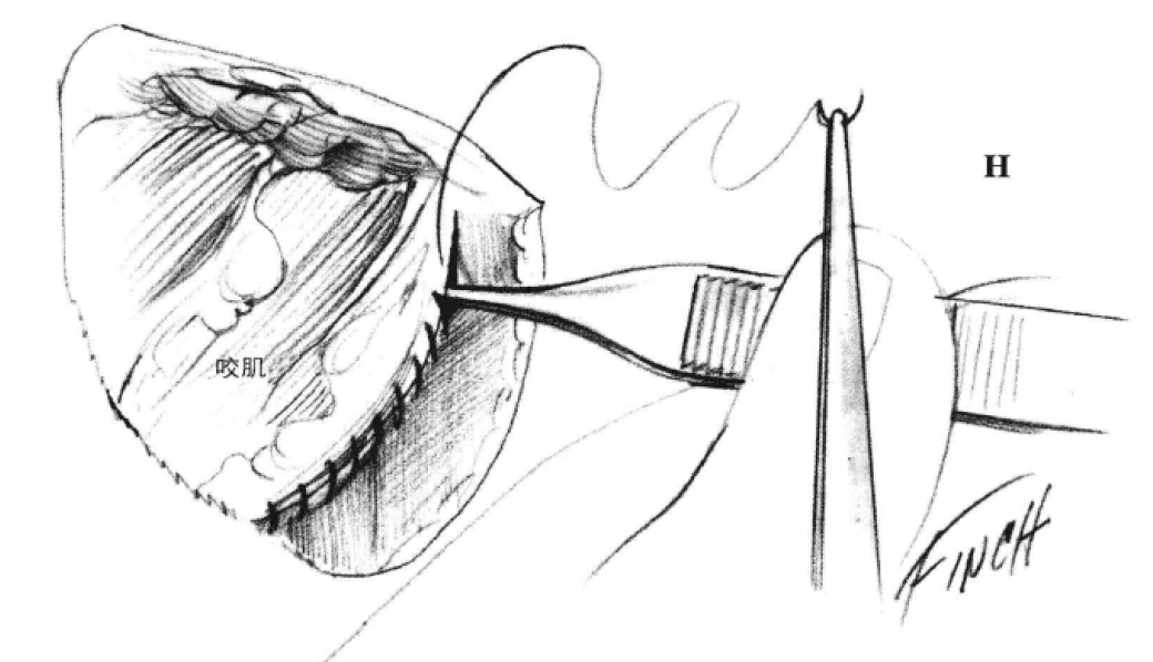 蜜桃成品人视频入口