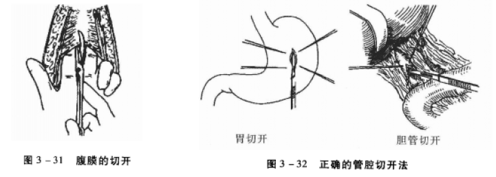 小动物腹膜的切开和管控切开法 蜜桃成品人视频入口