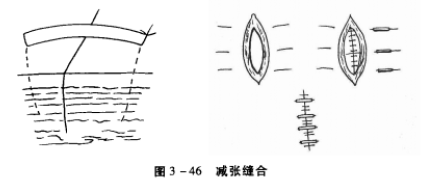 减张缝合 蜜桃成品人视频入口
