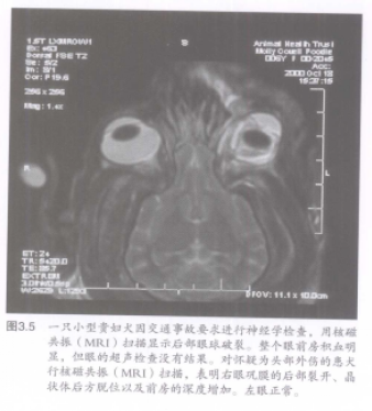 图3.5一只小型贵妇犬因交通事故要求进行神经学检查,周核磁 共择(MR1)扫播显示后部球破裂。整个眼前房积血明 黑,但眼的超声检查没有结果。对怀疑为头部外伤的大 行核磁共拯(MR1)4描。表明右眼膜的后部裂开、晶 状体后方脱位以及前房的深度增加。左眼正常 蜜桃成品人视频入口