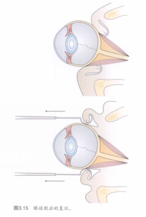 蜜桃成品人视频入口