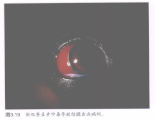 蜜桃成品人视频入口