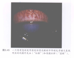 图3.45一只患有急性发作原发性青光眼的中年幅毛手犬表现 明显的现膜外充血(“红眼”)和角膜水肿(“蓝眼”) 蜜桃成品人视频入口