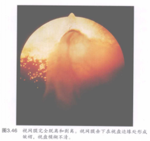 蜜桃成品人视频入口