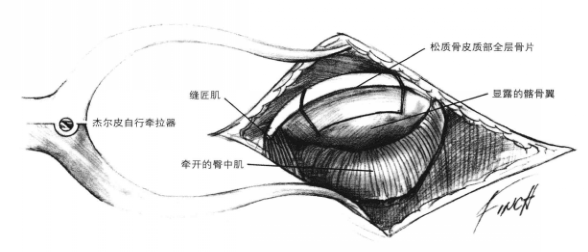 蜜桃成品人视频入口