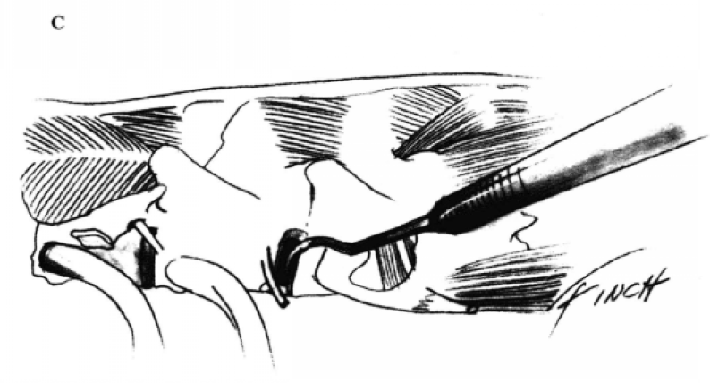 蜜桃成品人视频入口