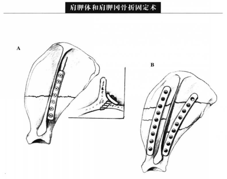蜜桃成品人视频入口
