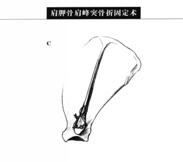 蜜桃成品人视频入口