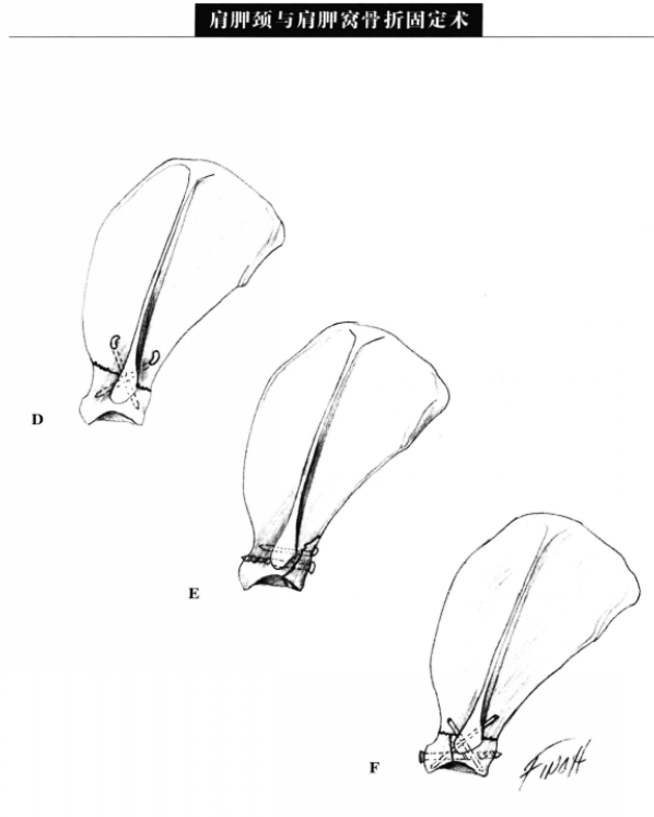 蜜桃成品人视频入口