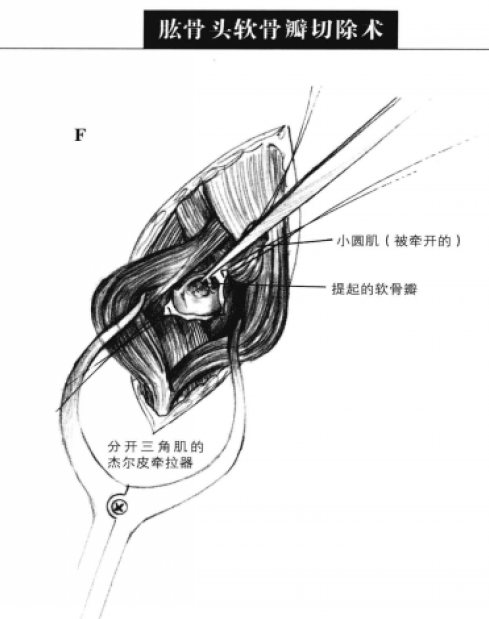 蜜桃成品人视频入口
