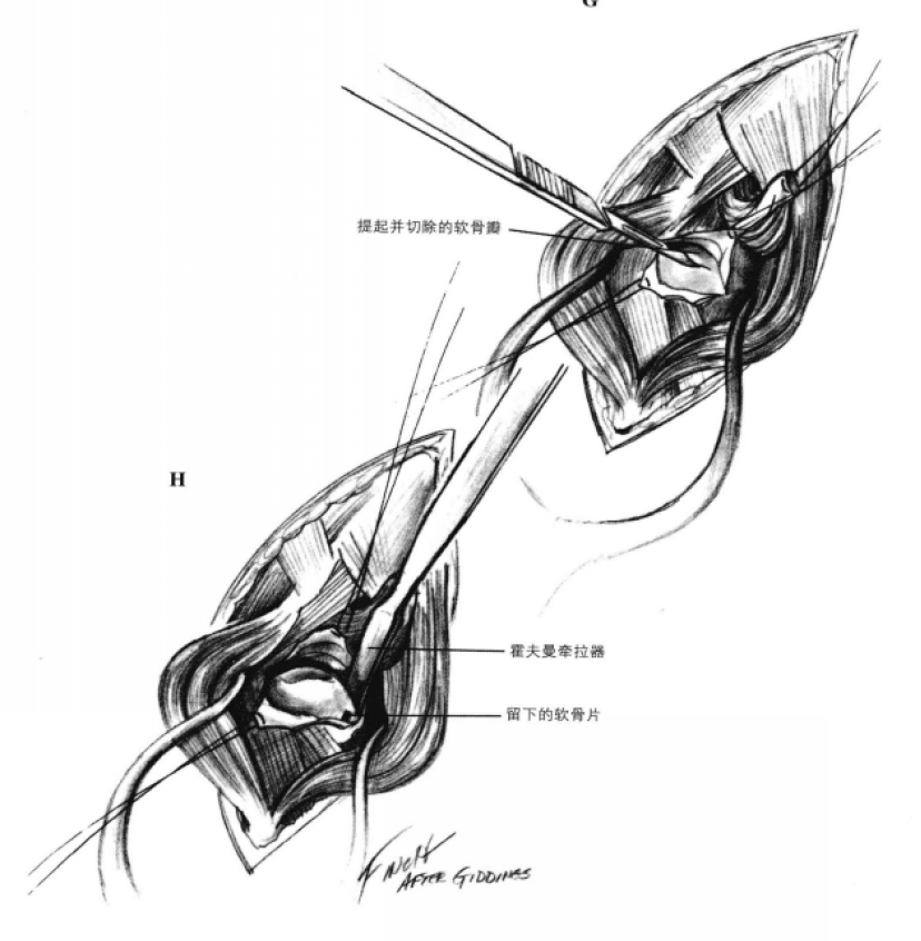 蜜桃成品人视频入口