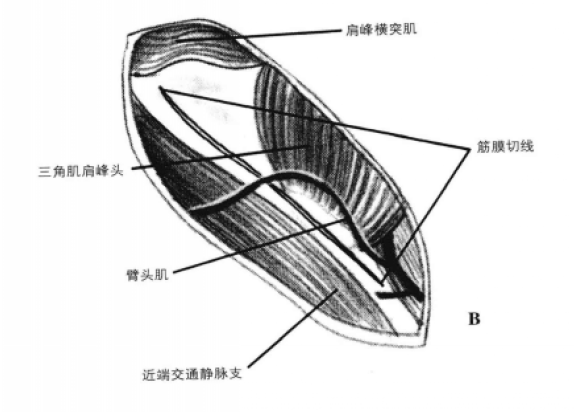 蜜桃成品人视频入口