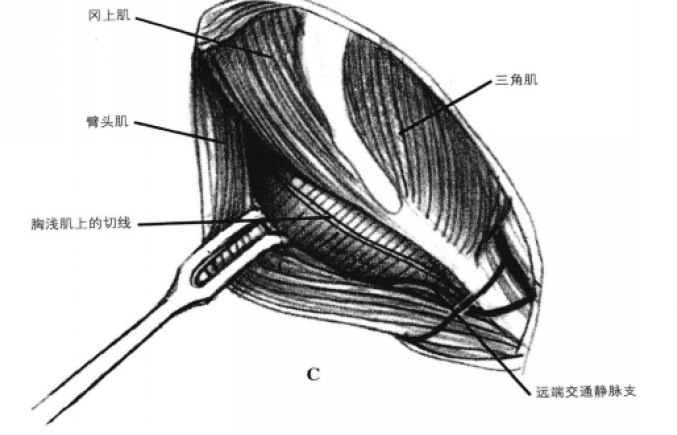 蜜桃成品人视频入口