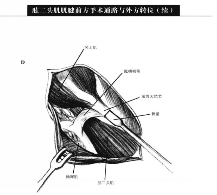 蜜桃成品人视频入口