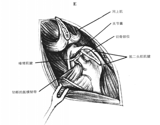 蜜桃成品人视频入口