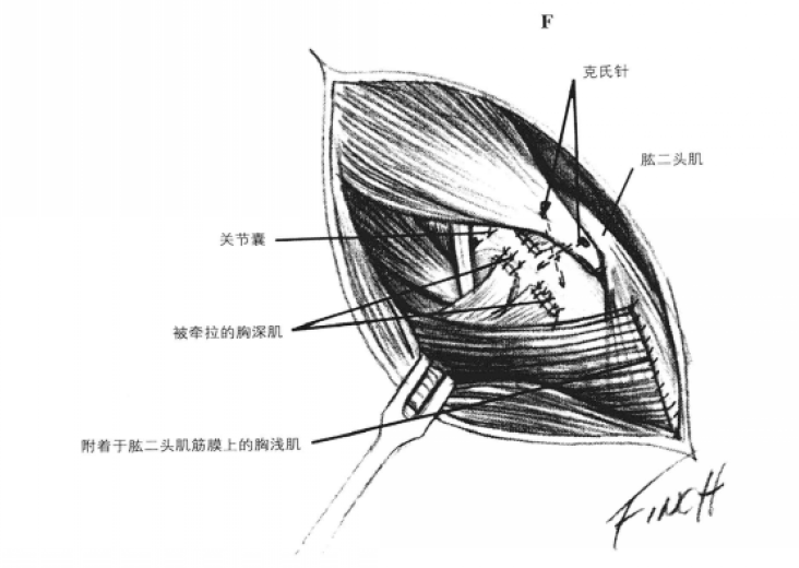 蜜桃成品人视频入口