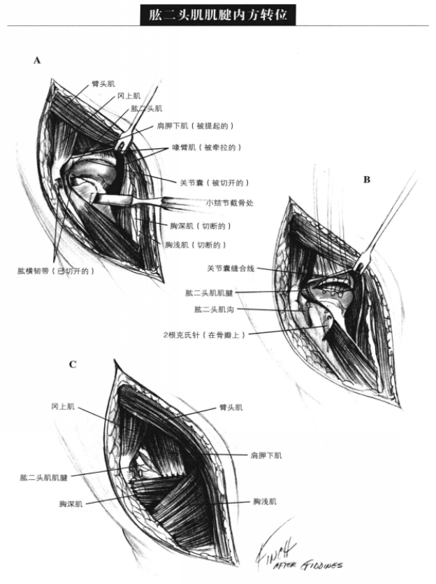 蜜桃成品人视频入口