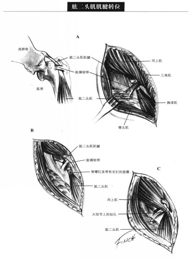 蜜桃成品人视频入口