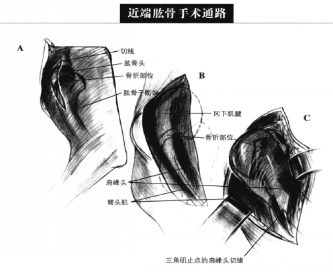近端肱骨手术通路 蜜桃成品人视频入口