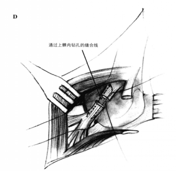 蜜桃成品人视频入口