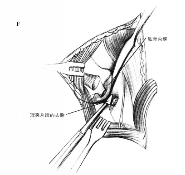 蜜桃成品人视频入口