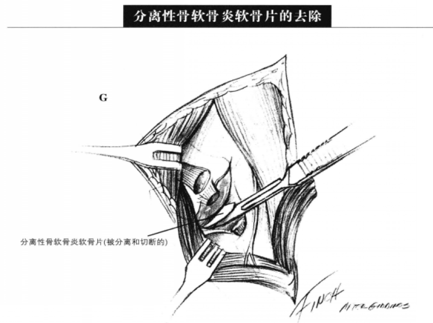 蜜桃成品人视频入口