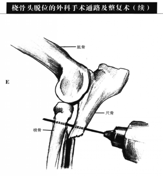 蜜桃成品人视频入口