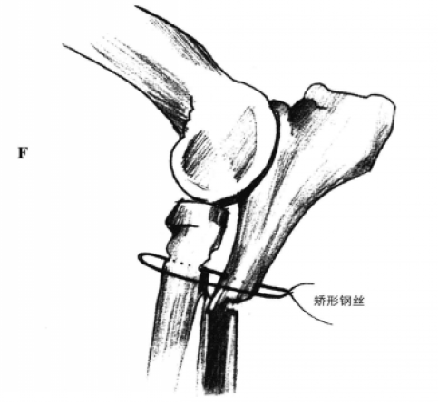 蜜桃成品人视频入口
