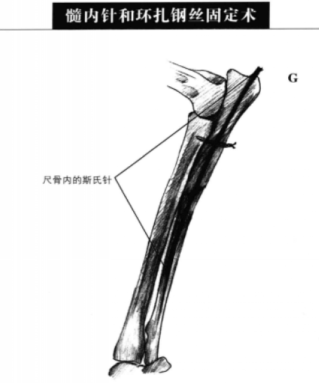 蜜桃成品人视频入口