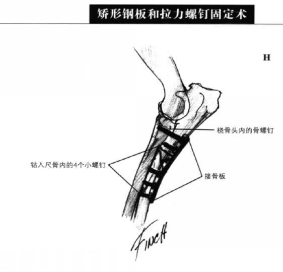蜜桃成品人视频入口