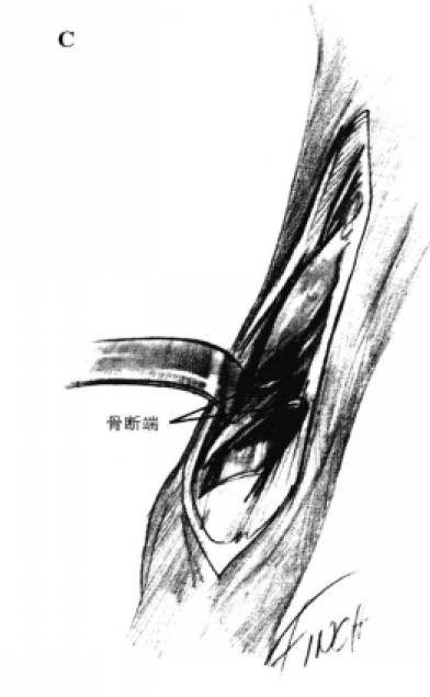 蜜桃成品人视频入口