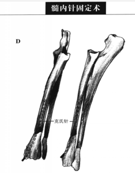 蜜桃成品人视频入口
