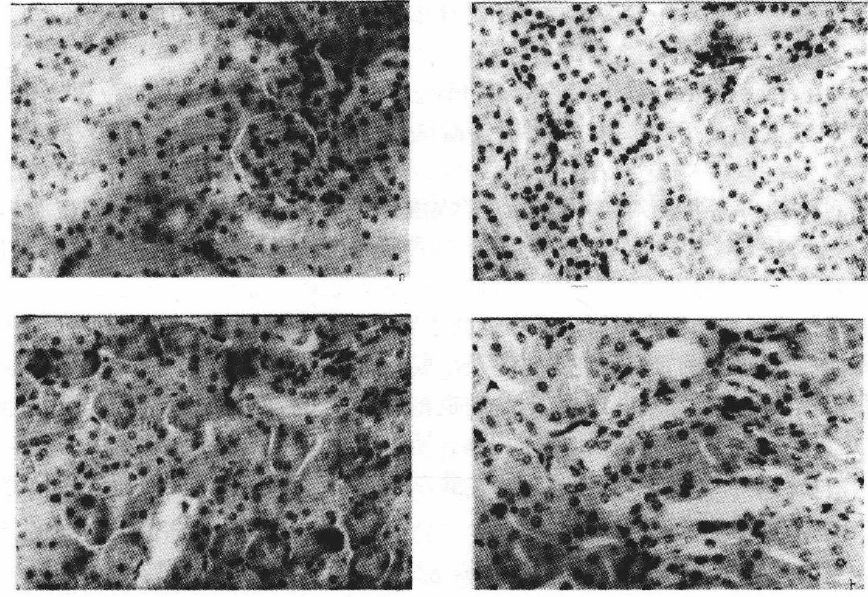 蜜桃成品人视频入口