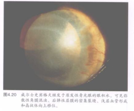 蜜桃成品人视频入口