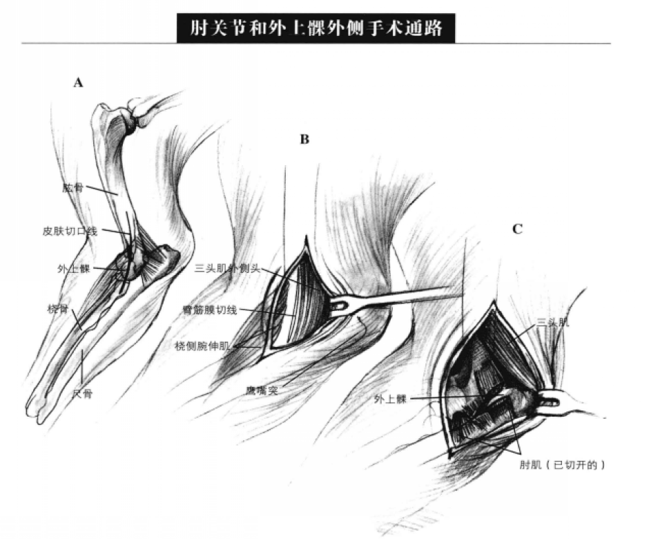 肘关节和外上髁外侧手术通路 蜜桃成品人视频入口