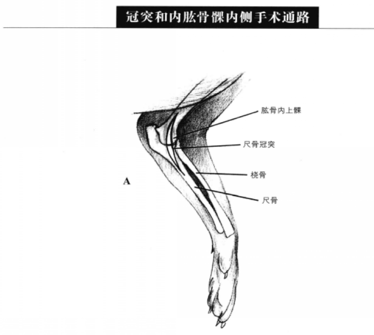 冠突和内肱骨髁内侧手术通路 蜜桃成品人视频入口