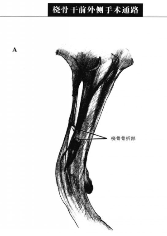 桡骨干前外侧手术通路 蜜桃成品人视频入口