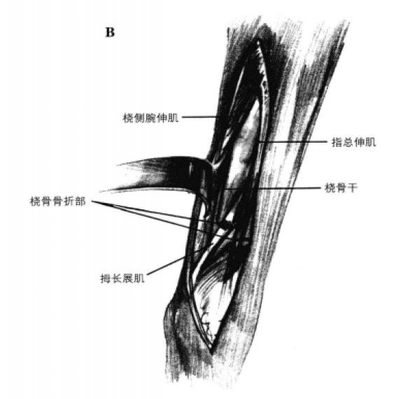 桡骨干前外侧手术通路 蜜桃成品人视频入口