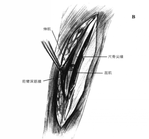 蜜桃成品人视频入口