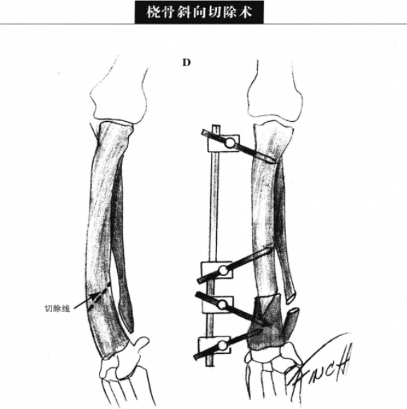 蜜桃成品人视频入口