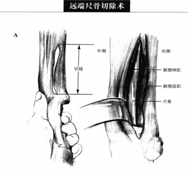 蜜桃成品人视频入口